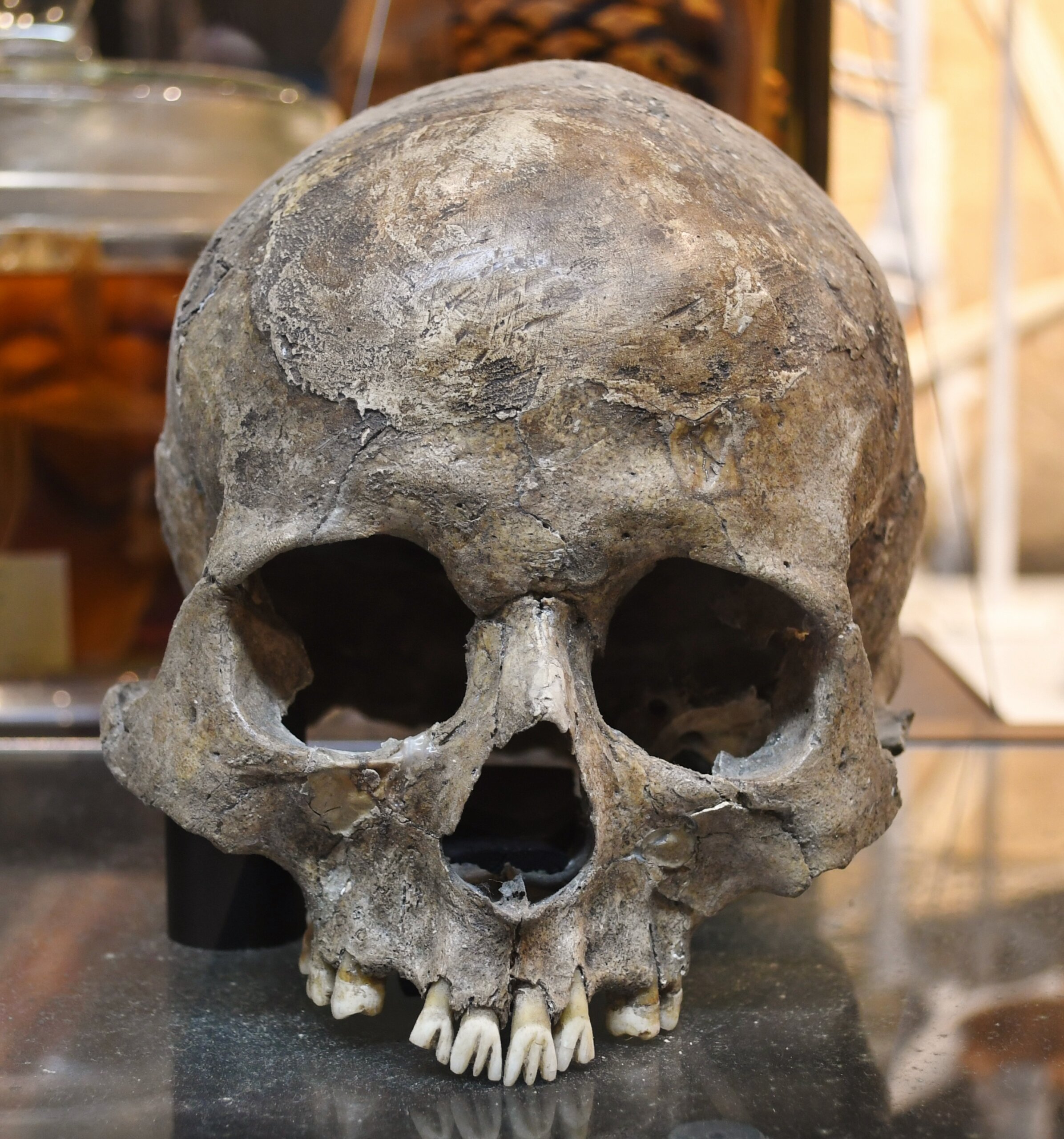 伊川津貝塚から出土した縄文時代の人の頭骨（叉状研歯あり）